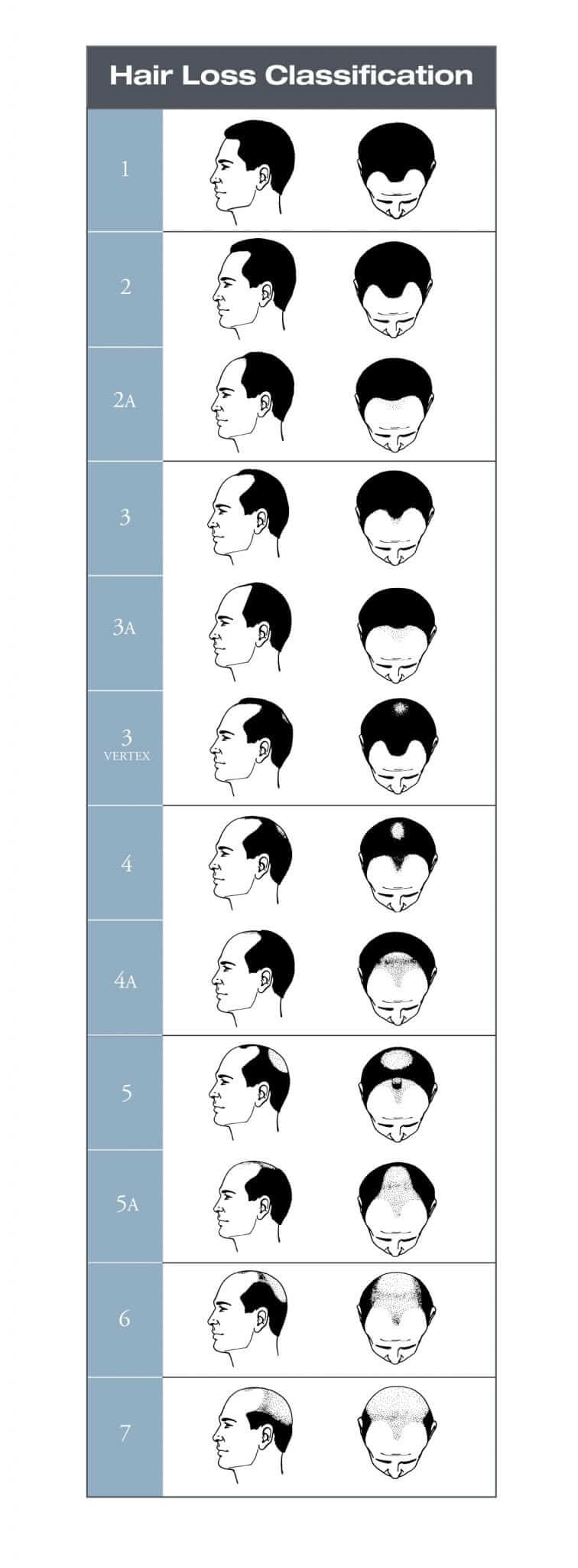 norwood scale