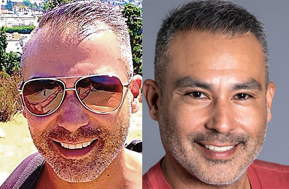 Bosley patient Edgar S before and after