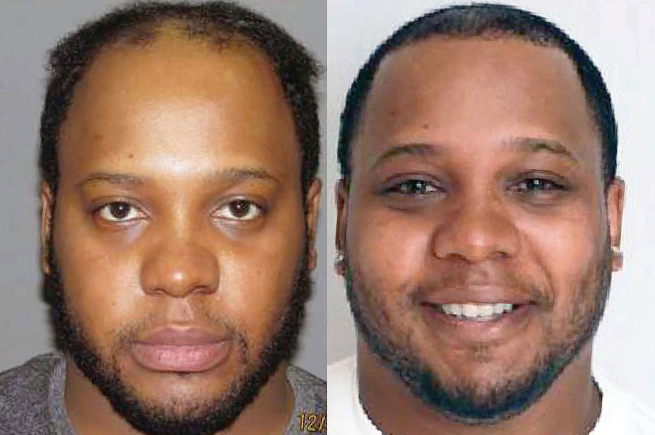 Bosley patient Jamil T. before and after