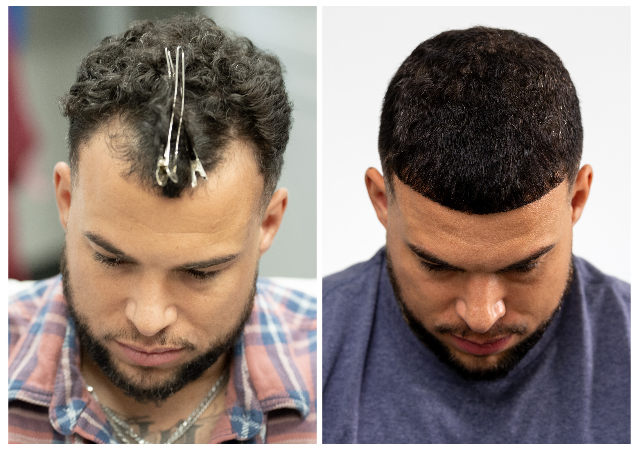 Chris GQ Perry Bosley before and after results