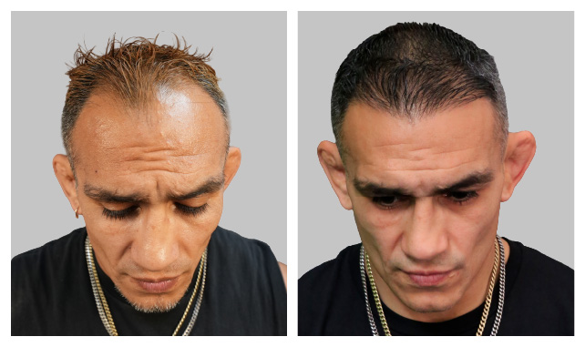 Tony Ferguson-LP-Image-B&A_B&A