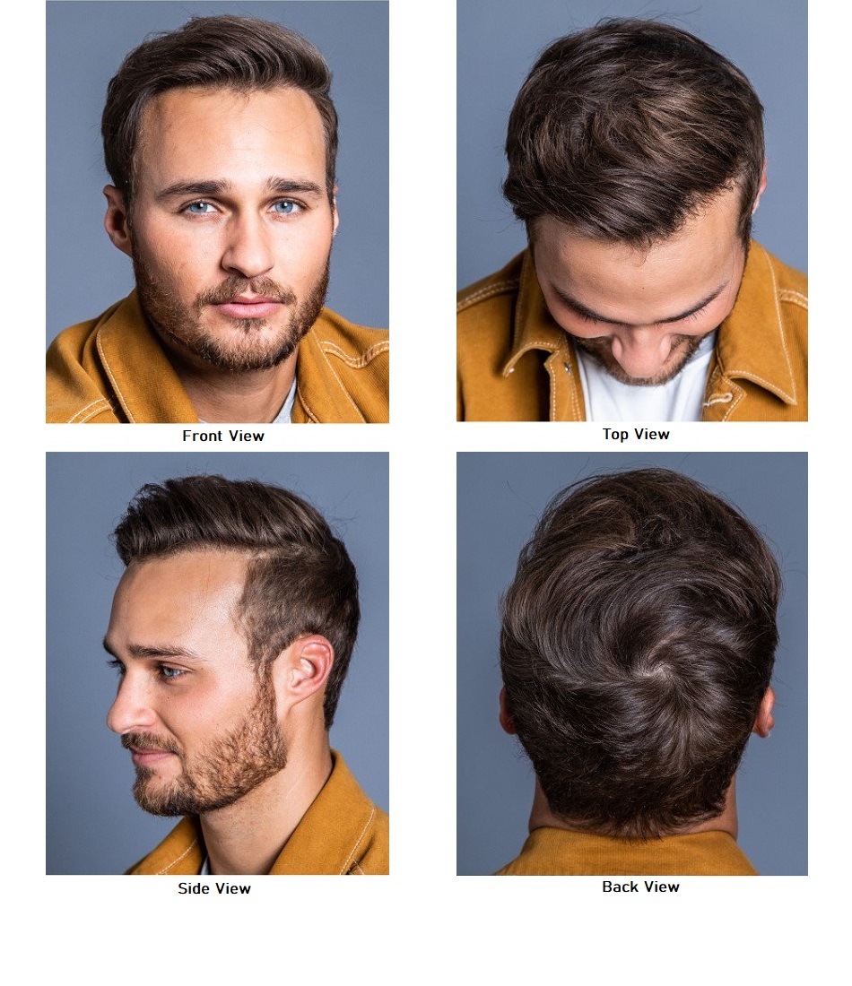 Before-and-After-Sample