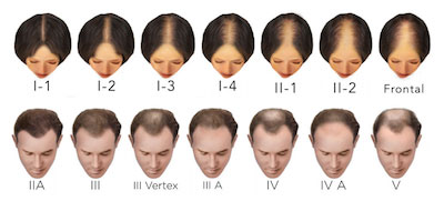 Ludwig-Savin on the top. Norwood-Hamilton on the bottom