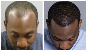 Raynard M. - Before and After