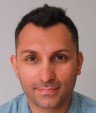 Bosley Patient Amir - Before