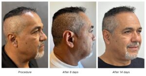rich shave free fue