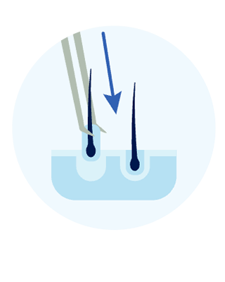 Step 3 image