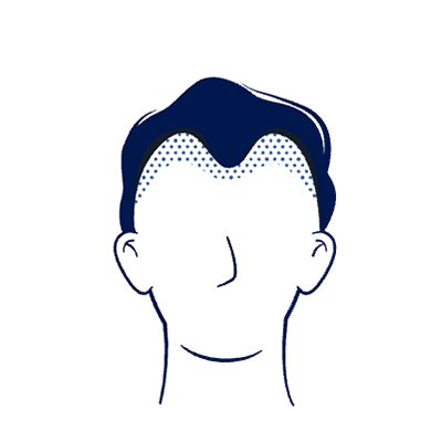 Step 2 image