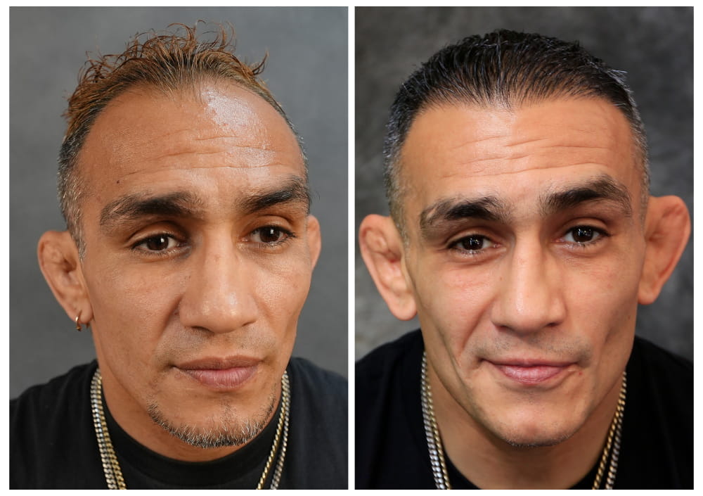 TonyFerguson-Frontjpg