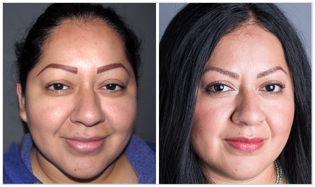 carmen D. Bosley before and after.